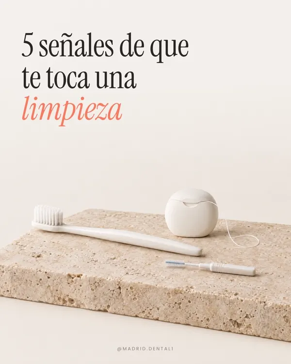Carrusel: 5 señales de que te toca una limpieza