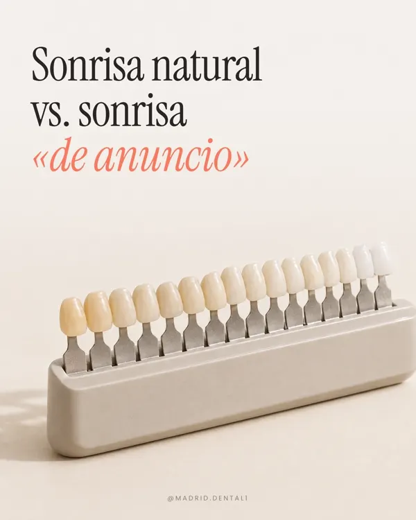 Carrusel: sonrisa natural vs. sonrisa de anuncio